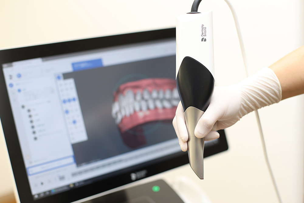 口腔内スキャナー